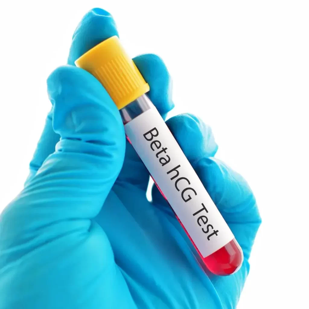 Blood Test For Pregnancy