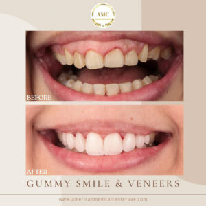 Dental in Dubai
