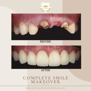Dental in Dubai