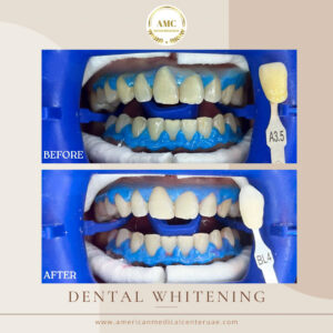 Dental in Dubai