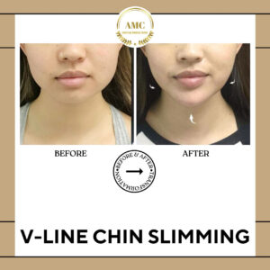 dermatologist in dubai