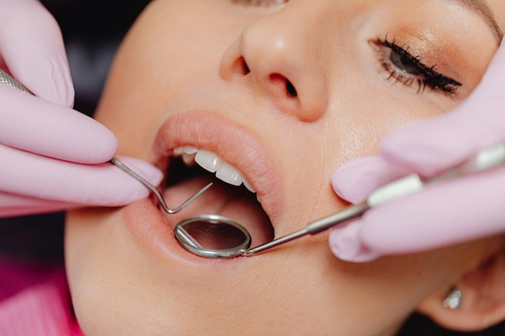 Teeth Scaling and Polishing Service in Dubai