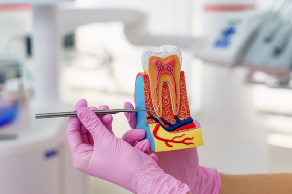 Root Canal Treatment