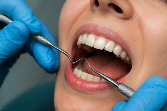 Teeth Cleaning