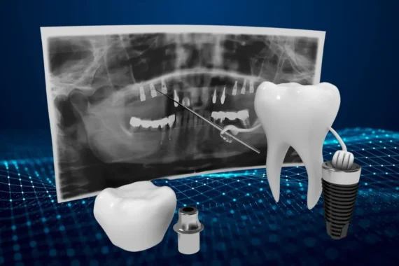 Digital Dentistry