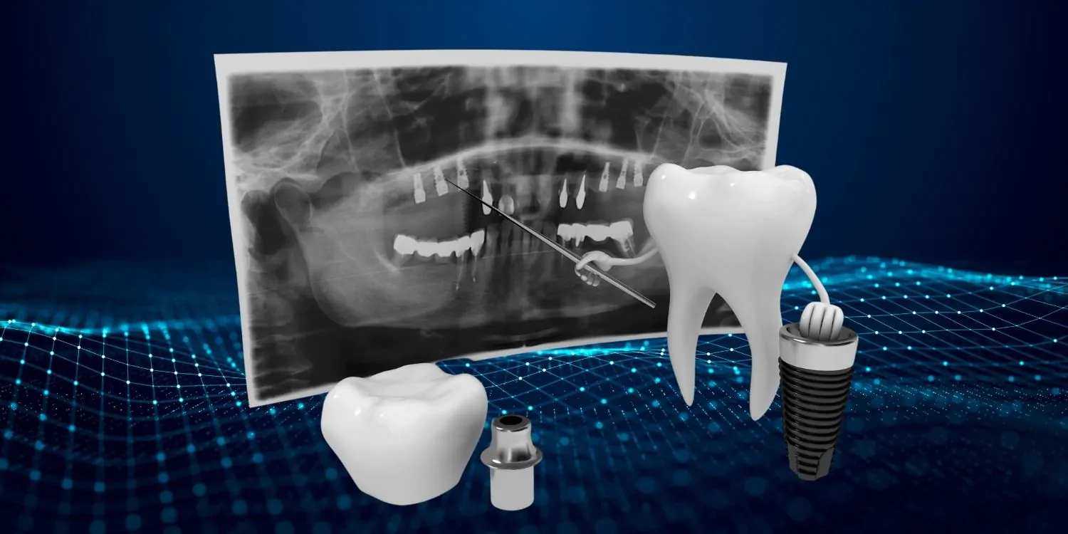 Digital Dentistry