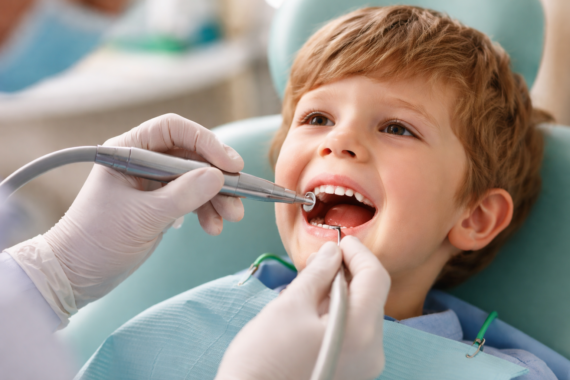 Cavities on Baby Teeth